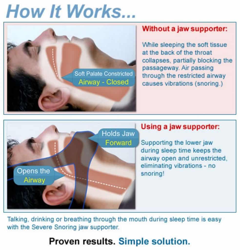 MySnoring Solutions promo code